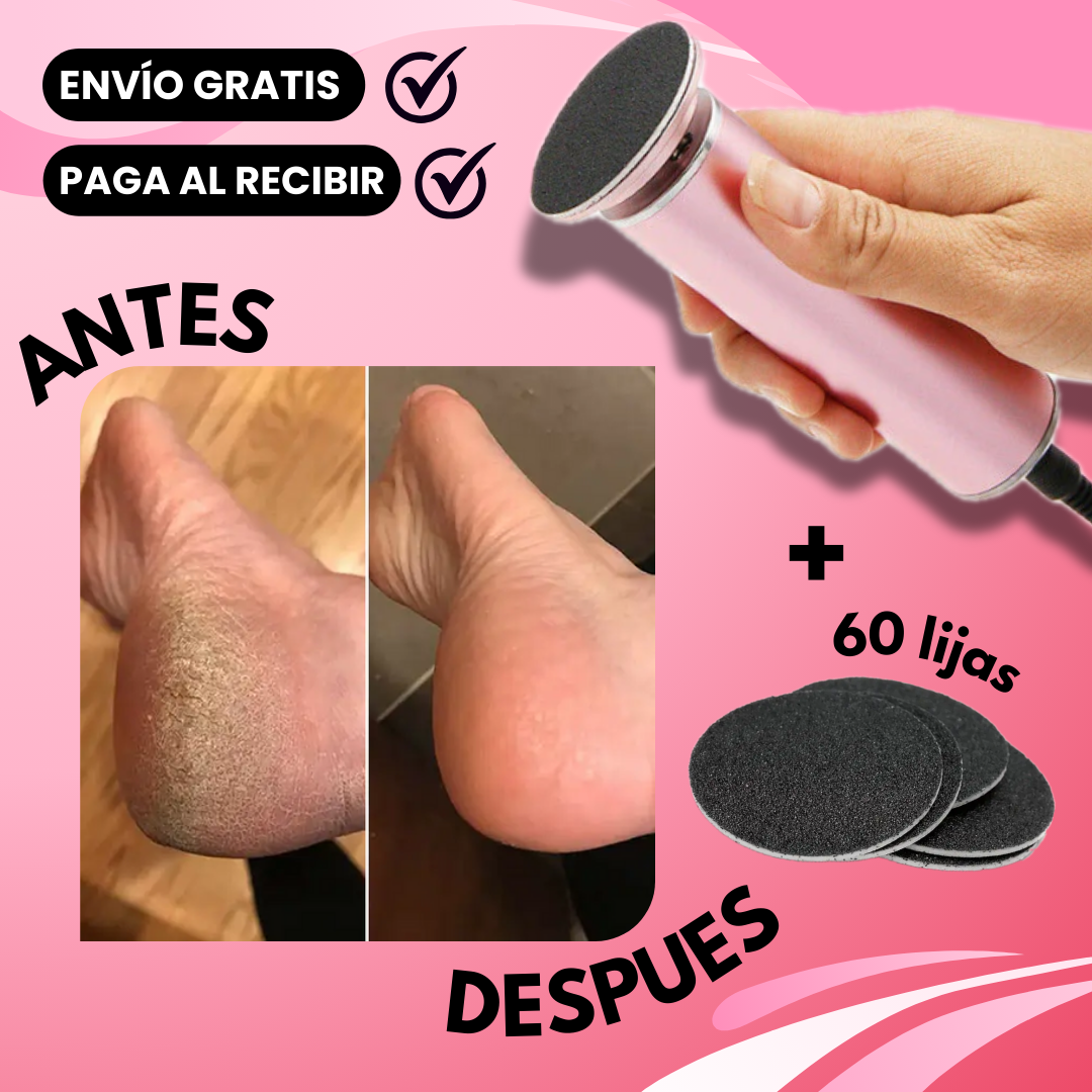 Removedor de callos FootSculpt® Pro + Lijas de repuesto